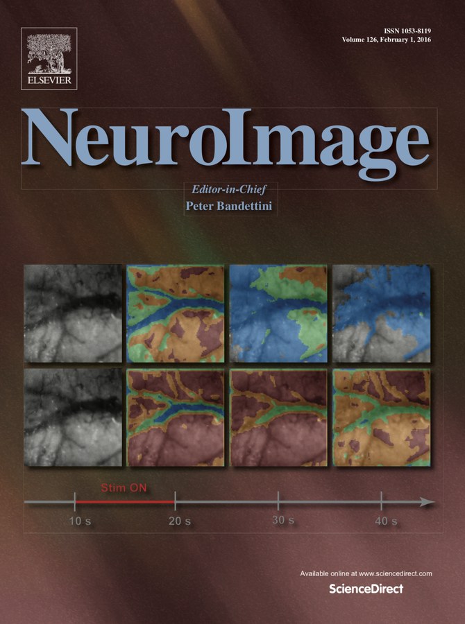 NeuroImage February 2016 cover featuring Noor lab research