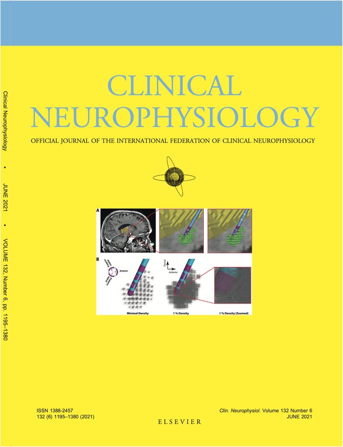 Clinical Neurophysiology June 2021 cover featuring Noor lab research